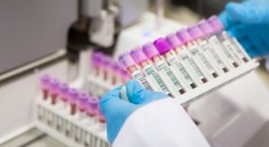 Investigación y cáncer de mama: así son los nuevos y esperanzadores avances