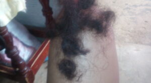 a kien se le cae el pelo asi