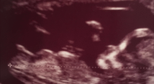 Protegido: Niño o niña’??