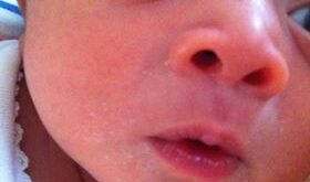 Protegido: Ed mi bebe soy federica