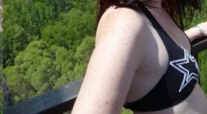 Protegido: mamoplastia