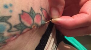 Protegido: abdominoplastia por clínica Ceme