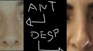 Protegido: Descargas de foros