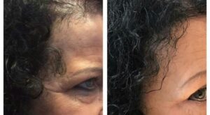 mejorando el cabello