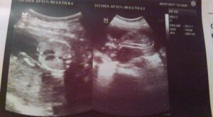 Mi precioso Heitan Miguel