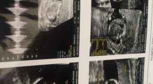 Protegido: Descargas de foros