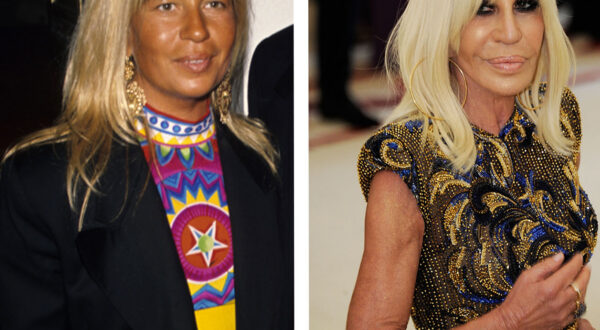 La evolución de Donatella Versace: un cambio drástico con cirugía