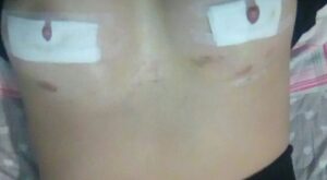 Protegido: Siliconas