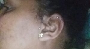 Pantalla de cartílago