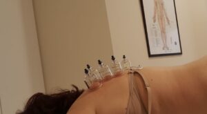 Acupuntura Eva Costa