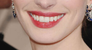 Las sonrisas de las celebrities: ¡Adivina a quién pertenecen!