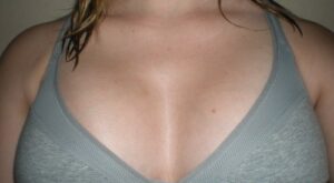 Protegido: Mis lolas